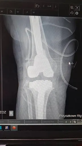 Zawadzki Piotr, lek. med. ortopeda